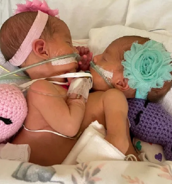 Addison and Lilianna Altobelli Family: Meet The Parents Of The Conjoined Twins Separated From Surgery